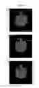 Fig. 13 - Method for densitometric analysis of computed tomography image