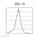 Fig. 19 - Method for densitometric analysis of computed tomography image
