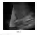 Fig. 03 - Segment-based flash suppression in ultrasound color flow