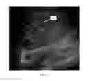 Fig. 05 - Segment-based flash suppression in ultrasound color flow