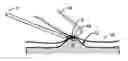 Fig. 01 - Apparatus for safely and accurately excising core tissue samples from palpated nodules or surface lesions