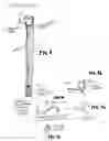 Fig. 07 - Multi-function dermatological biopsy instrument