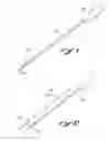 Fig. 07 - METHODS AND APPARATUS FOR SECURING MEDICAL INSTRUMENTS TO DESIRED LOCATIONS IN A PATIENT'S BODY