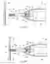 Fig. 24 - Catheter based fastener implantation apparatus and methods