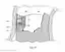 Fig. 27 - Catheter based fastener implantation apparatus and methods