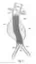 Fig. 29 - Catheter based fastener implantation apparatus and methods