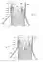 Fig. 32 - Catheter based fastener implantation apparatus and methods