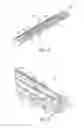 Fig. 04 - Devices and methods for securing fasteners and adjunct materials to tissue