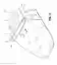 Fig. 12 - Surgical stapling apparatus