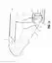 Fig. 15 - Surgical stapling apparatus