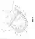 Fig. 35 - Surgical stapling apparatus