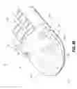 Fig. 41 - Surgical stapling apparatus