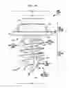Fig. 03 - Bone fixture for medical prosthesis