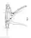 Fig. 03 - Minimally invasive surgical assembly and methods