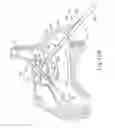 Fig. 09 - Method and apparatus for forming opening in a sinus wall