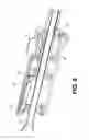 Fig. 07 - Compact endoscopic surgical blade assembly and method of use thereof