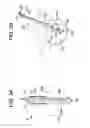 Fig. 06 - Disc nucleus removal devices and methods