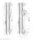 Fig. 02 - ROTATIONAL ATHERECTOMY DEVICE WITH FLUID INFLATABLE SUPPORT ELEMENTS AND TWO TORQUE TRANSMITTING COILS