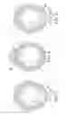 Fig. 03 - ROTATIONAL ATHERECTOMY DEVICE WITH FLUID INFLATABLE SUPPORT ELEMENTS AND TWO TORQUE TRANSMITTING COILS