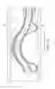 Fig. 18 - ROTATIONAL ATHERECTOMY DEVICE WITH FLUID INFLATABLE SUPPORT ELEMENTS AND TWO TORQUE TRANSMITTING COILS