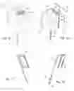 Fig. 14 - Subcutaneous sensor inserter and method