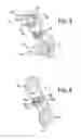 Fig. 03 - Fastener, spinal interbody system including same and method