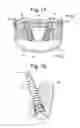 Fig. 11 - Fastener, spinal interbody system including same and method