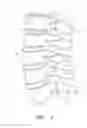 Fig. 02 - Flanged interbody fusion device