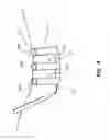 Fig. 06 - ROD DELIVERY TOOL FOR USE IN PEDICLE SCREW SYSTEMS