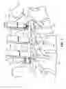 Fig. 12 - ROD DELIVERY TOOL FOR USE IN PEDICLE SCREW SYSTEMS