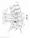 Fig. 16 - ROD DELIVERY TOOL FOR USE IN PEDICLE SCREW SYSTEMS