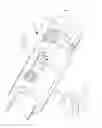 Fig. 03 - Bone Distraction Device Having a Quick Release Disengagement Mechanism