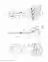 Fig. 02 - System and method of soft tissue anchoring to metaphyseal bone plate