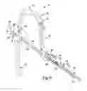 Fig. 12 - METHOD AND APPARATUS FOR ORTHOPEDIC FIXATION