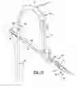Fig. 13 - METHOD AND APPARATUS FOR ORTHOPEDIC FIXATION