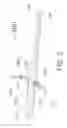 Fig. 03 - Method for painless renal denervation using a peri-vascular tissue ablation catheter with support structures