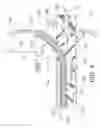 Fig. 05 - Method for painless renal denervation using a peri-vascular tissue ablation catheter with support structures