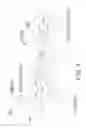 Fig. 07 - Method for painless renal denervation using a peri-vascular tissue ablation catheter with support structures