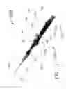 Fig. 10 - Method for painless renal denervation using a peri-vascular tissue ablation catheter with support structures