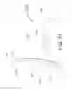 Fig. 12 - Method for painless renal denervation using a peri-vascular tissue ablation catheter with support structures