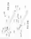 Fig. 19 - Method for painless renal denervation using a peri-vascular tissue ablation catheter with support structures