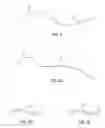 Fig. 05 - INTEGRATED SUTURE AND CAUTERIZATION
