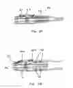 Fig. 05 - ELECTROSURGICAL DEVICE