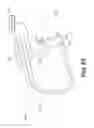 Fig. 29 - DEVICES FOR DAMAGING NERVES AND RELATED METHODS OF USE