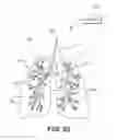 Fig. 30 - DEVICES FOR DAMAGING NERVES AND RELATED METHODS OF USE