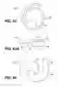 Fig. 40 - DEVICES FOR DAMAGING NERVES AND RELATED METHODS OF USE