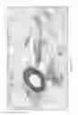 Fig. 03 - METHODS FOR MODULATING RENAL NERVE TISSUE AND ASSOCIATED SYSTEMS AND DEVICES