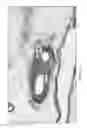 Fig. 05 - METHODS FOR MODULATING RENAL NERVE TISSUE AND ASSOCIATED SYSTEMS AND DEVICES
