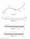 Fig. 02 - Electrosurgical pericardial puncture