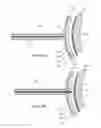 Fig. 04 - Electrosurgical pericardial puncture